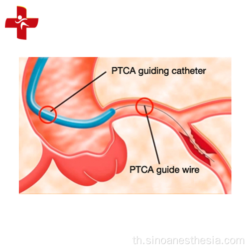 ผลิตภัณฑ์หัวใจและหลอดเลือดคุณภาพสูง PTCA Guidewire